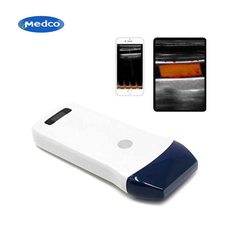 Wireless B-ultrasound probe