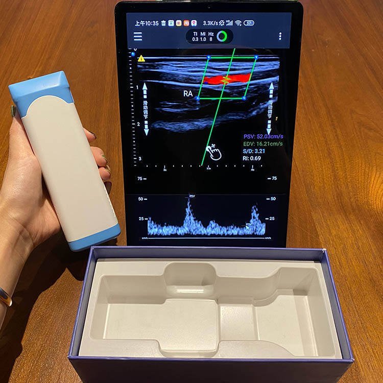 Portable Wireless ultrasound probe for android ultrasound wireless probe