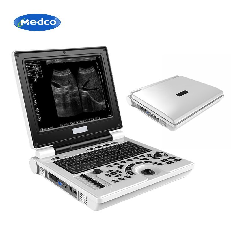 B Ultrasound -PU33A