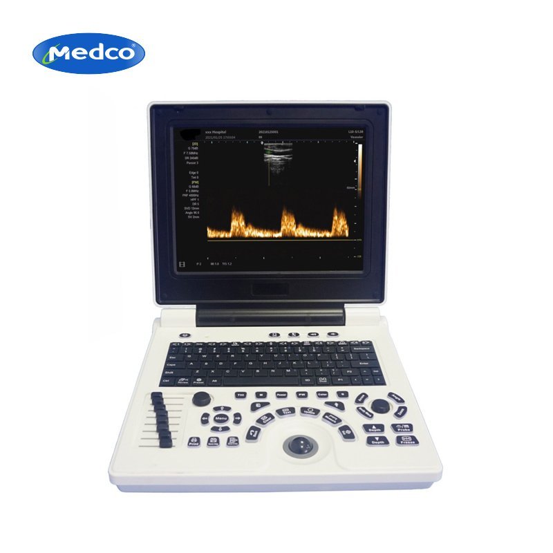 Laptop Portable Color Doppler Ultrasound Machine