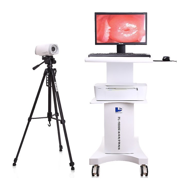 Hospital diagnostic instrument wholesale price portable colposcope