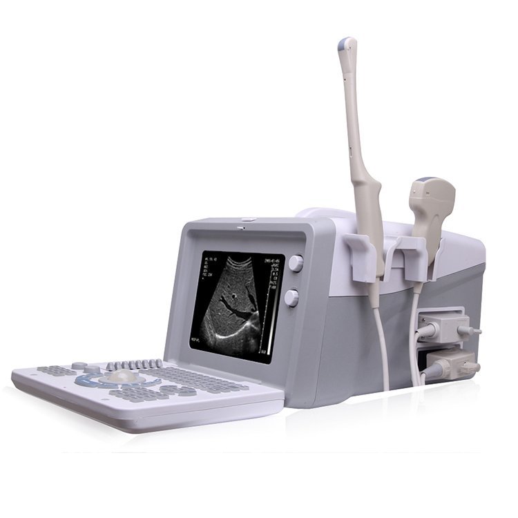12 Inch HD LCD display rechargeable battery cheap price portable ultrasound machine