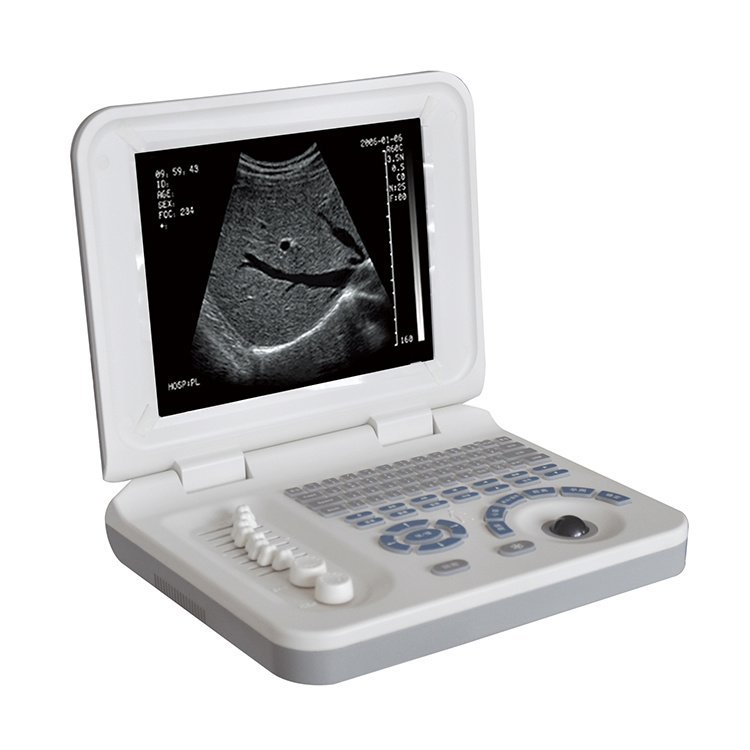 Hospital use good quality medical equipment portable ultrasound doppler machine