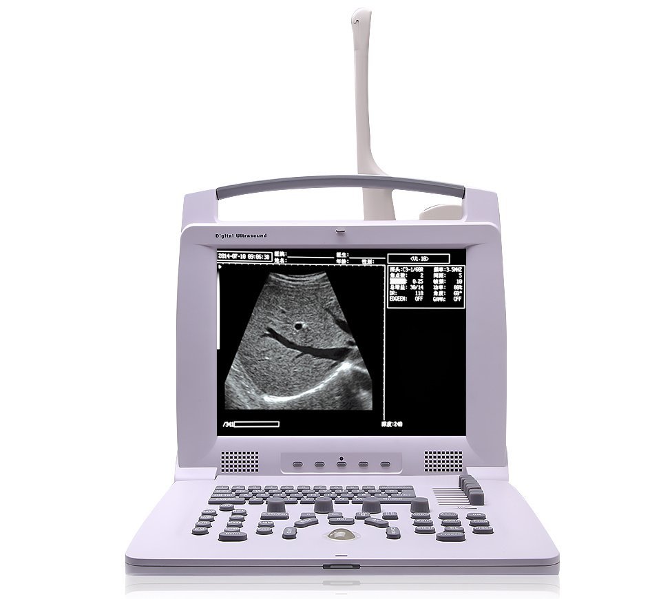 Hospital use good quality medical equipment portable ultrasound doppler machine 2