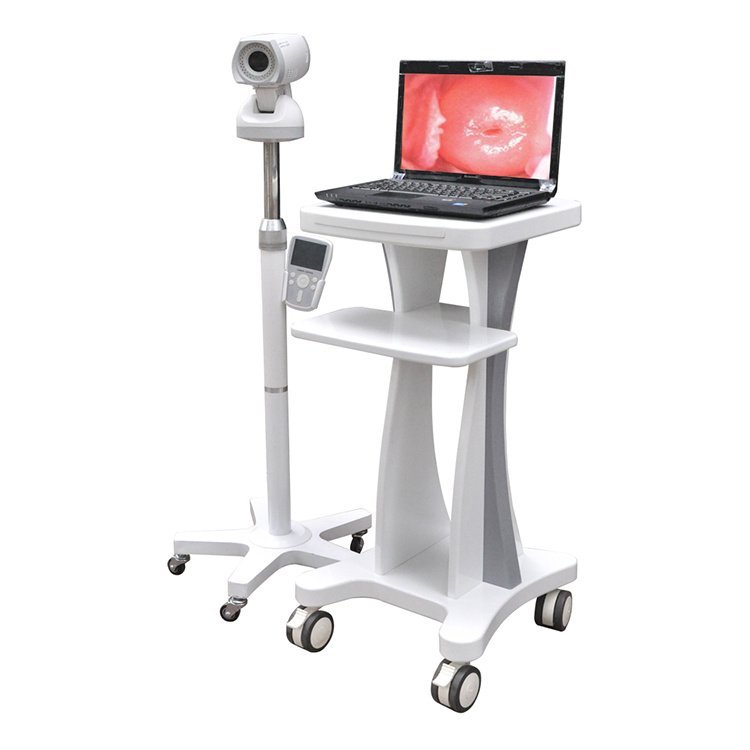 LED video display 220V 500W electronic colposcope for gynecology